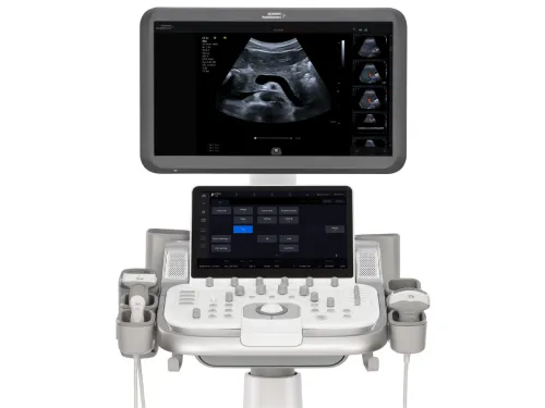 Aparat Ultrasonograficzny Acuson Maple SIEMENS siemens-healthineers-us-acuson-maple-hero-new-4x3.webpAparat Ultrasonograficzny Acuson Maple SIEMENS-2