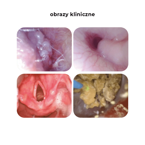 Endoskop weterynaryjny USB wielorazowy obrazy-kliniczne-endoskop-USB.png