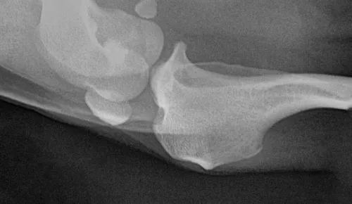 Radiografia cyfrowa i-SENSOR Pluto0006X WhatsApp Image 2026-09-23 at 11.49.57.jpeg