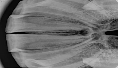 Radiografia cyfrowa i-SENSOR Pluto0006X WhatsApp Image 2026-09-23 at 11.49.50.jpeg