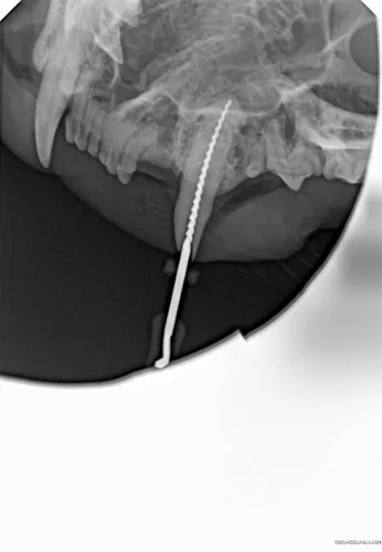 Radiografia cyfrowa i-SENSOR Pluto0006X WhatsApp Image 2026-09-23 at 11.49.22.jpeg