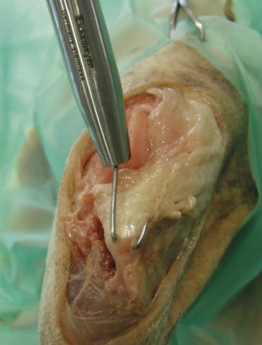 Tuleja-giętarka do drutów Kirschnera Giętarka-2.jpg