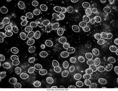Mikroskop Delta Optical Genetic Pro Trino Delta-Optical-Genetic-Pro-Bino-14.jpg