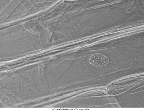 Mikroskop Delta Optical Genetic Pro Trino Delta-Optical-Genetic-Pro-Bino-11.jpg