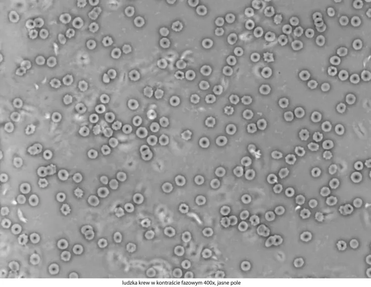 Delta-Optical-Genetic-Pro-Bino-6.jpg