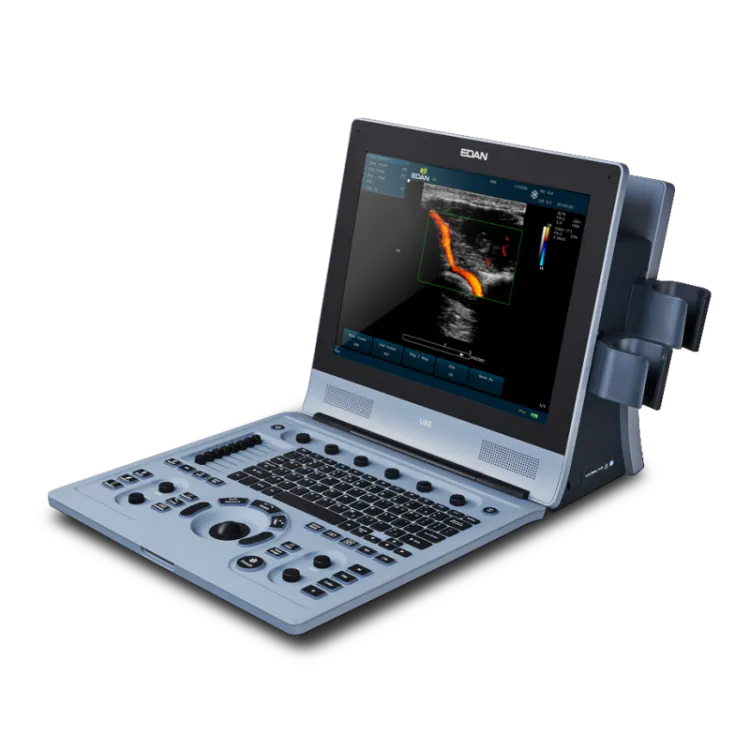 ultrasonograf-u60-vet-kolor-doppler-premium (1).jpg