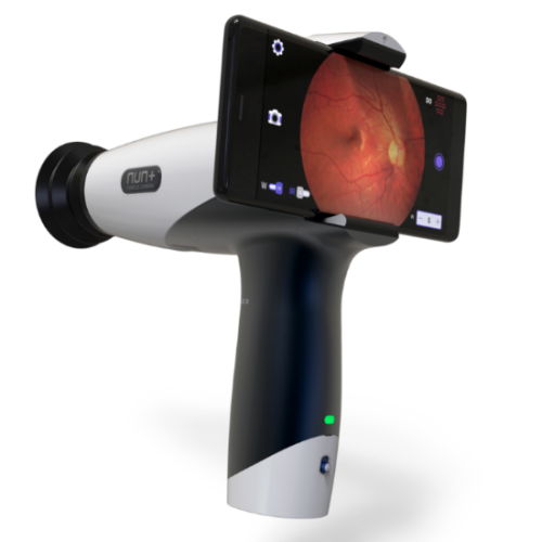Fundus Kamera NUN+ podłączona do smartfona – gotowa do wykonania zdjęcia dna oka. Widoczna lekka, przenośna konstrukcja i układ optyczny kamery.