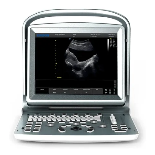 Ultrasonograf weterynaryjny CHISON ECO5 VET Ultrasonograf CHISON ECO5 VET z kolorowym Dopplerem do diagnostyki weterynaryjnej w gabinecie i w terenie