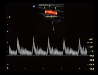 Ultrasonograf weterynaryjny CHISON ECO5 VET Ultrasonograf CHISON ECO5 VET z kolorowym Dopplerem do diagnostyki weterynaryjnej w gabinecie i w terenie