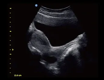 Ultrasonograf weterynaryjny CHISON ECO5 VET Ultrasonograf CHISON ECO5 VET z kolorowym Dopplerem do diagnostyki weterynaryjnej w gabinecie i w terenie